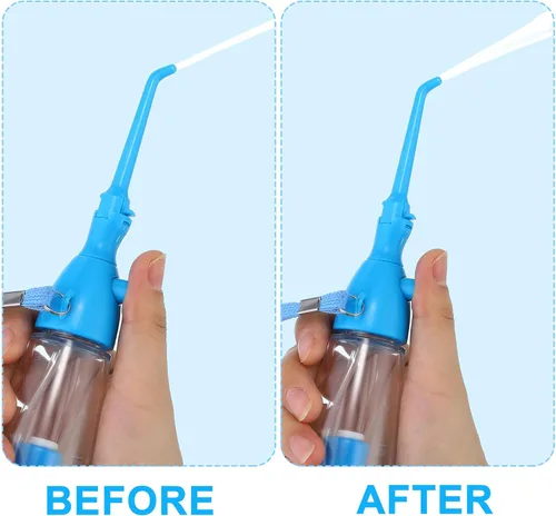 Vista 2 de Irrigador dental de agua para dientes Irrigador oral Limpiador de dientes de agua, no eléctrico, portátil, asequible, irrigador oral inalámbrico