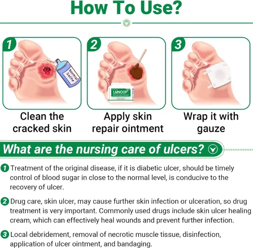 Vista 6 de Ungüento curativo de úlceras cutáneas, para úlceras de pies y piernas, llagas, úlceras varicosas, úlceras por estasis, úlceras por decúbito, cortes