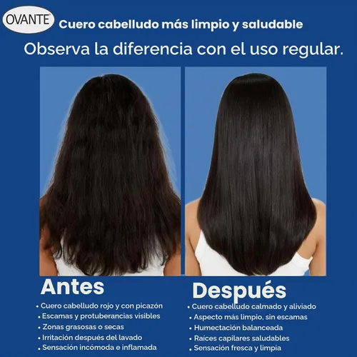 Vista 5 de Solución para foliculitis en champú natural, 6 onzas líquidas