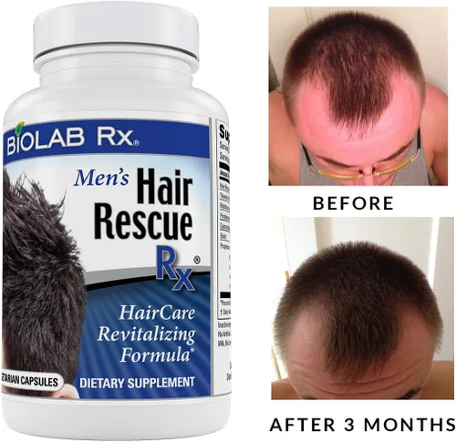 Vista 6 de Hair Rescue Rx - Suplemento para adelgazar el cabello para hombre con biotina y ortiga, soporta un cabello más grueso y saludable, soporte