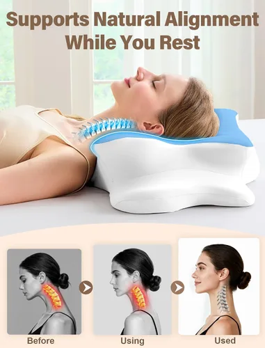 Vista 4 de Almohada cervical para el cuello para aliviar el dolor, almohada ergonómica de espuma viscoelástica para dormir de lado, almohada ortopédica de cama