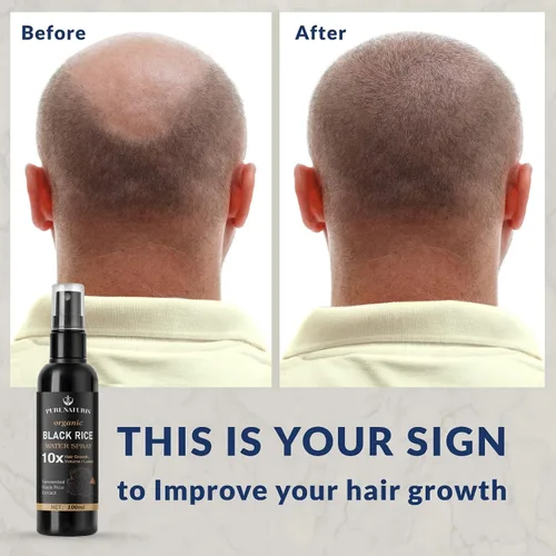 Vista 5 de PureNaturis Aceite de ricino y jengibre para el crecimiento del cabello, suero sin enjuague para hombres y mujeres, eficaz para la pérdida
