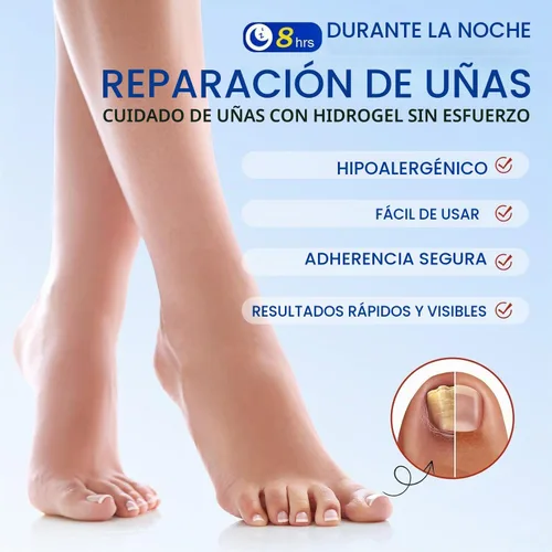 Vista 5 de Parches de uñas, parches de uñas para uñas de los pies, parches de tratamiento de uñas extra fuertes, yesos de uñas extra fuertes de 8 horas