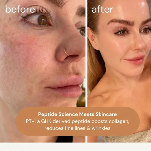 Vista 3 de KOA Life GHK Peptide Daily Ultra-Hidratante, Aceite Facial Antienvejecimiento. En una botella cuentagotas de vidrio de cobre metálico y cartón