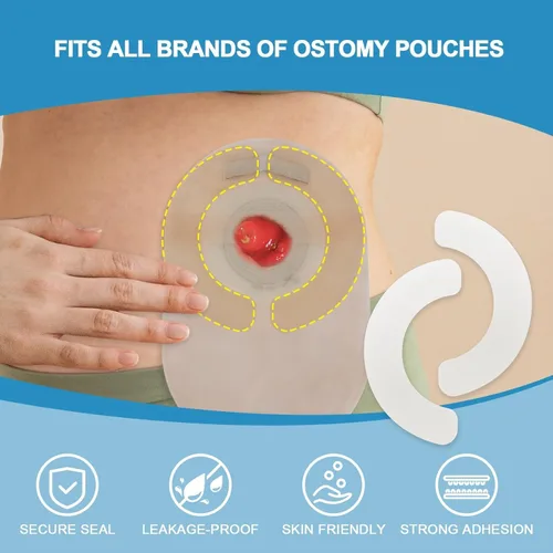 Vista 4 de 30 tiras de barrera para ostomía 20 bolsas de colostomía sistema de una pieza