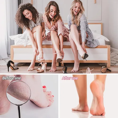 Vista 6 de Topmeet Removedor de callos de pies, lima profesional de acero inoxidable para piel muerta, callos y piel dura, diseño ergonómico para pies suaves