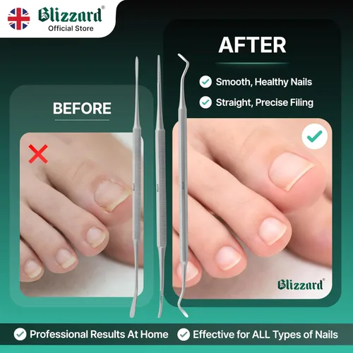 Vista 5 de Blizzard Juego de pedicura de lima negra de alta calidad, kit de 3 piezas de uñas encarnadas, limpiador de uñas de doble cara, lima de uñas
