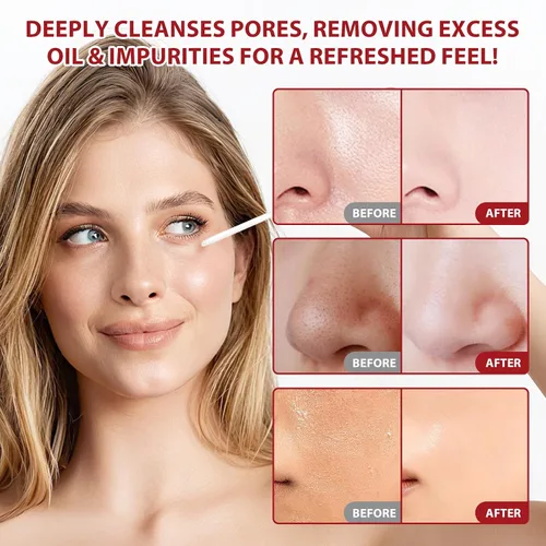 Vista 8 de Paquete de 2 ampollas de arroz Peel Shot Glow Dúo, exfoliante de arroz blanco y negro para todo tipo de piel, minimizador hidratante de poros