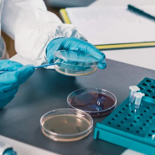 Vista 5 de Xuhal Platos Petri estériles de plástico con tapa de 3.543 in de diámetro x 0.630 in, placa Petri para análisis de laboratorio, experimentos