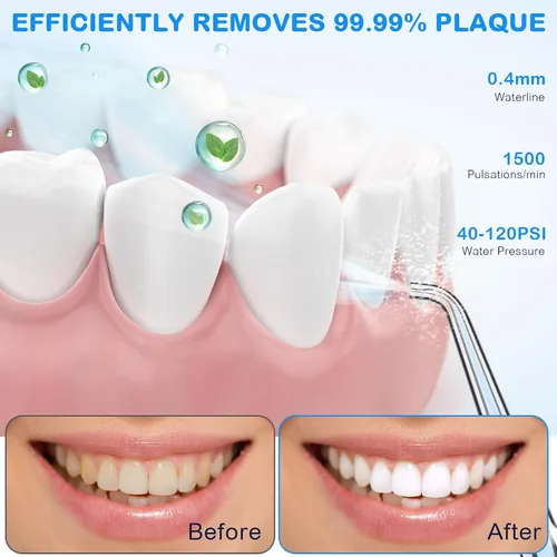 Vista 2 de Irrigador dental de agua para limpieza de dientes y hilo dental con funda de tamaño de viaje, irrigador oral recargable, irrigador dental portátil