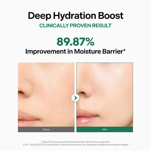 Vista 4 de Crema ultra intensiva, hidratante facial coreano hidratante con extractos de niacinamida, arginina y algas11, crema de barrera no grasa para pieles