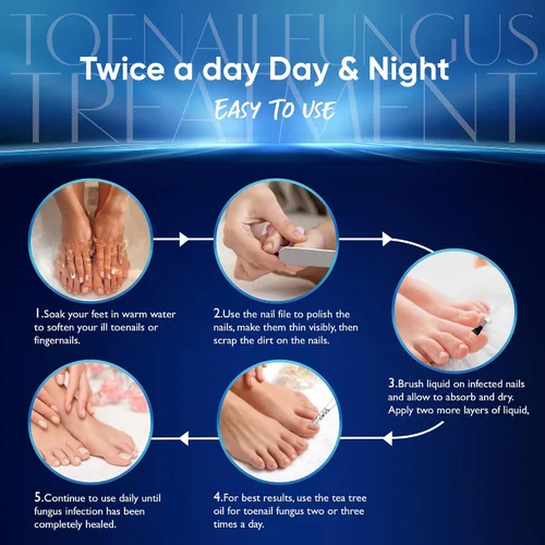 Vista 5 de Tratamiento de hongos para uñas de los pies, tratamiento de hongos en las uñas de los pies, extra fuerte, tratamiento de hongos en las uñas