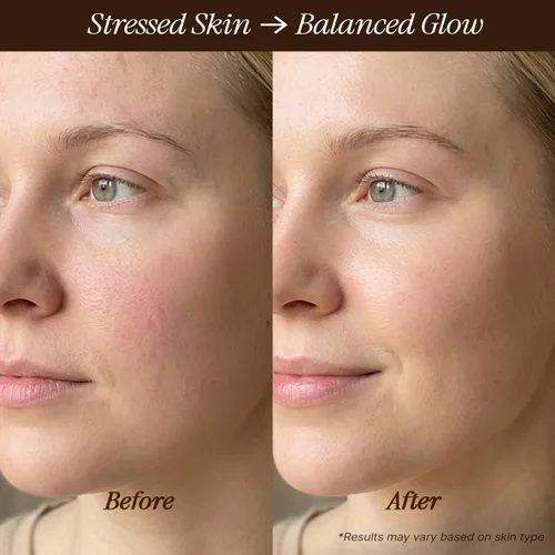 Vista 2 de Aceite facial orgánico USDA, fabricado en Estados Unidos con ingredientes naturales, fórmula antienvejecimiento para pieles propensas al acné