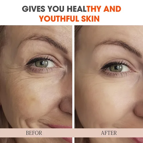 Vista 6 de Suero súper vitamina C para mujeres mayores de 70 años, paquete total todo en uno, suero facial para piel madura, hidratante, levantamiento