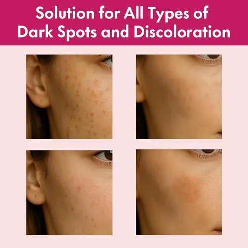 Vista 4 de Arbutin 7% + ácido tranexámico 4% crema facial para manchas oscuras y tono de piel desigual - Hidratante, no irritante, segura para pieles