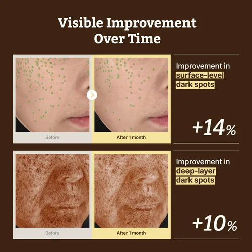 Vista 5 de Dr.Reju-All Suero avanzado de retino-mela, suero de retinol HPR para la cara, antienvejecimiento, minimizador de poros, cuidado de la piel coreano