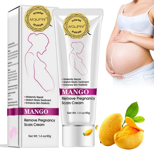 Vista 5 de RtopR Mango Crema para estrías y cicatrices - Crema para estrías y eliminación de cicatrices para el embarazo, la mejor crema hidratante corporal