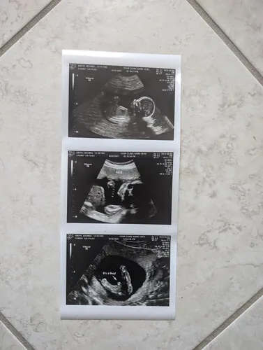 Vista 4 de Broma 2D personalizada tira de ultrasonido falso de 3 fotos