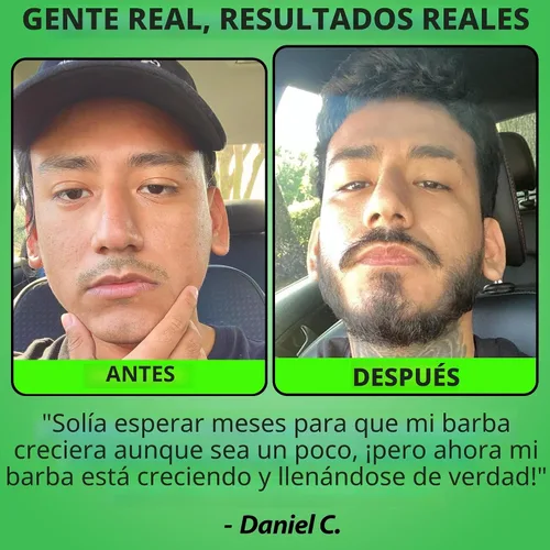 Vista 3 de Minoxidil para el crecimiento de la barba: suero al 5% con 2 veces biotina y agua de arroz, promueve el cabello facial más grueso y lleno, ideal