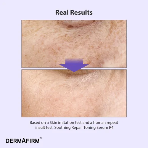 Vista 2 de Reabastecer DERMAFIRM Suero Tonificante Reparador Calmante R4 - Suero Facial Coreano Bakuchiol Retinol Niacinamida y Péptido para Arrugas