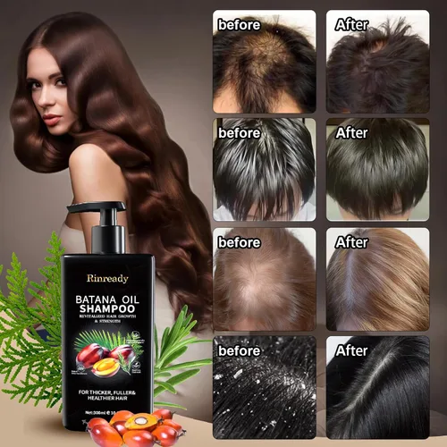 Vista 4 de Batana - Champú de romero para cabello adelgazante, champú fortalecedor de biotina para hombres y mujeres, cuidado nutritivo del cuero cabelludo