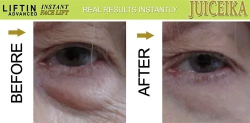 Vista 3 de LIFTIN Advanced" INSTANT FACE LIFT de Juiceika. ¡Este es un INCREÍBLE 60 SEGUNDO CARA LIFTIN!