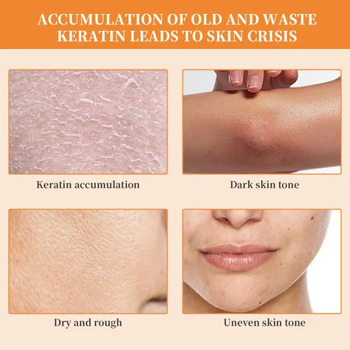 Vista 2 de Exfoliante de gel exfoliante naranja para la cara y la piel del cuerpo, exfoliante facial de gel natural de color naranja, limpiador profundo