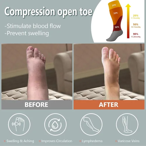 Vista 3 de Abodhu Calcetines de compresión de talla grande con punta abierta para mujeres y hombres, 15-20mmHg pantorrilla ancha hasta la rodilla, calcetines