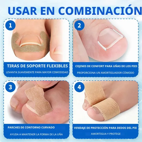 Vista 3 de Kit de cuidado de uñas encarnadas con tiras flexibles (134 piezas), kit de herramientas profesional para uñas de los pies incluye bandas
