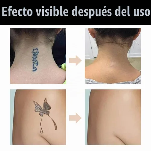 Vista 3 de Cubierta de tatuaje, corrector invisible impermeable para el cuerpo, piernas, contusiones, cicatrices, manchas oscuras, vitíligo, maquillaje