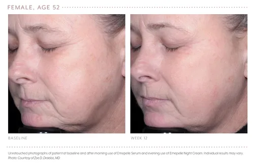 Vista 6 de Emepelle Suero facial con tecnología MEP, suero iluminador y ultra hidratante para piel envejecida con antioxidantes, ácido hialurónico y péptidos