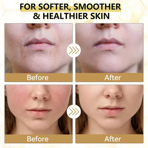 Vista 4 de Sarga de ternera para la piel, sargo orgánico y bálsamo de miel para la cara, hidratante facial natural, crema para el cuidado de la piel de ternera