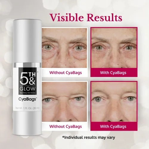 Vista 3 de 5th & Glow Cyabags - Reducción instantánea de ojos hinchados y suero removedor de bolsas debajo de los ojos para mujeres, ácido hialurónico y crema