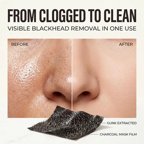 Vista 3 de Máscara facial negra con polvo de carbón activado, máscara eliminadora de puntos negros coreanos para nariz y cara, limpiador de poros, máscara