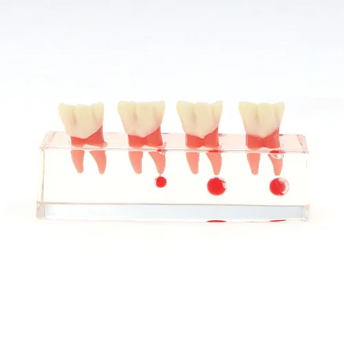 Vista 3 de Modelo de tratamiento endodóntico Dentalmall, de cuatro etapas, para enseñar a estudiantes, modelo 4018