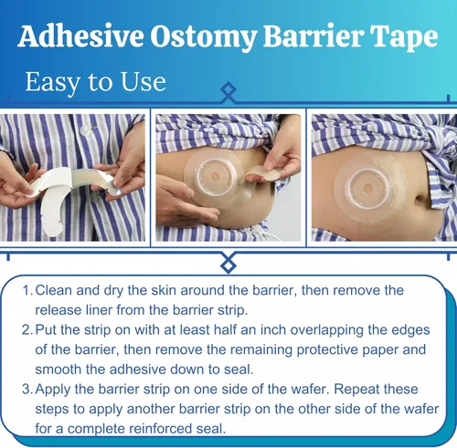 Vista 6 de 40 tiras de barrera para ostomía con huecos, suministros elásticos de urostomía de ileostomía, cintas extensoras de barrera cutánea para bolsas