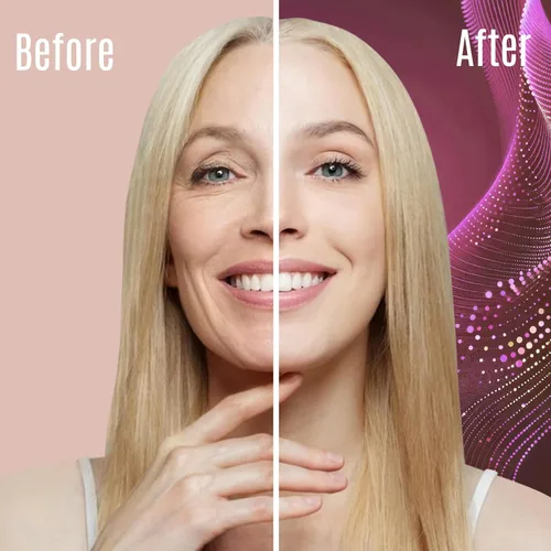 Vista 6 de Crema de retinol – 3% (porcentaje) crema de retinol para cara con ácido hialurónico – Crema facial antienvejecimiento para líneas finas y arrugas