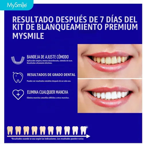 Vista 2 de MySmile Kit de bandejas blanqueadoras de dientes precargadas de 7 tratamientos con gel blanco de peróxido de hidrógeno al 12% para dientes