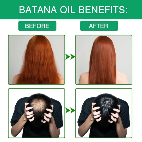 Vista 4 de Aceite de batana para el tratamiento del cabello para una nutrición profunda y cuidado