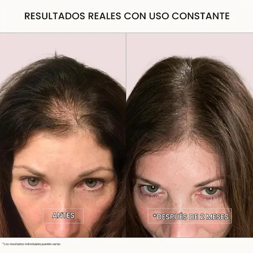 Vista 2 de ACTIIV Recover - Paquete de champú y acondicionador espesante para mujer