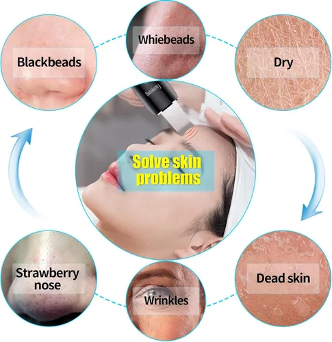 Vista 5 de Limpiador facial de piel con pulverizador, pulverizador mejorado, extractor de puntos negros para limpieza profunda e hidratante en aerosol