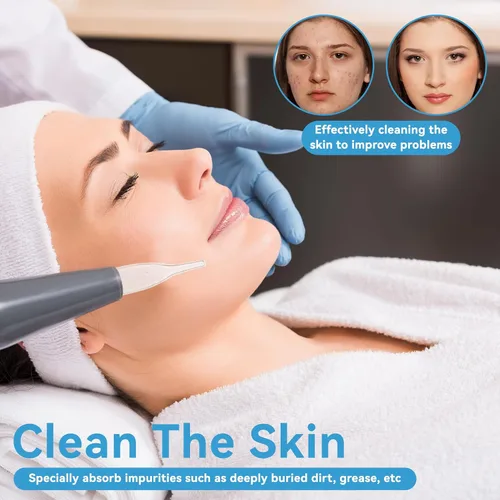 Vista 3 de Kit de tubo de vidrio al vacío, 3 piezas, eliminación de puntos negros, aspirador de poros de succión facial para limpiador facial, máquina