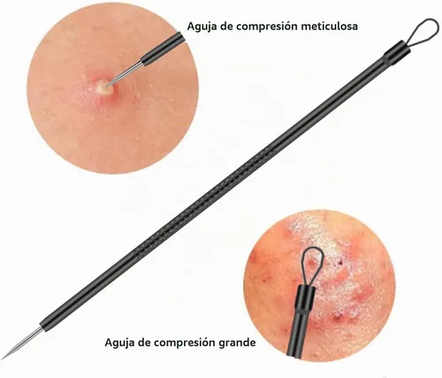 Vista 5 de Kit de herramientas para eliminar espinillas, 4 piezas, herramienta extractor de espinillas para nariz y cara, juego de herramientas de eliminación