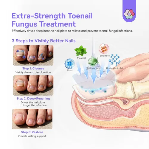 Vista 4 de SAVILAND Tratamiento de Hongos en las Uñas de los Pies de Fuerza Extra: 2X Reparación Extrema de Uñas para Uñas Decoloradas y Dañadas Suavizante