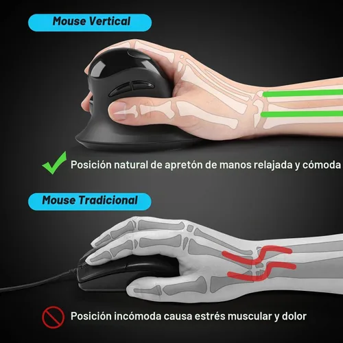 Vista 2 de MicroPack Ratón ergonómico, ratón inalámbrico vertical con USB A y receptor tipo C, diseño ergonómico que reduce la tensión muscular, ratón de 6