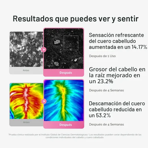 Vista 4 de medicube Rosemary PDRN - Juego coreano para el cuidado del cabello: champú, acondicionador y suero Aminoácidos para un cabello más grueso, más