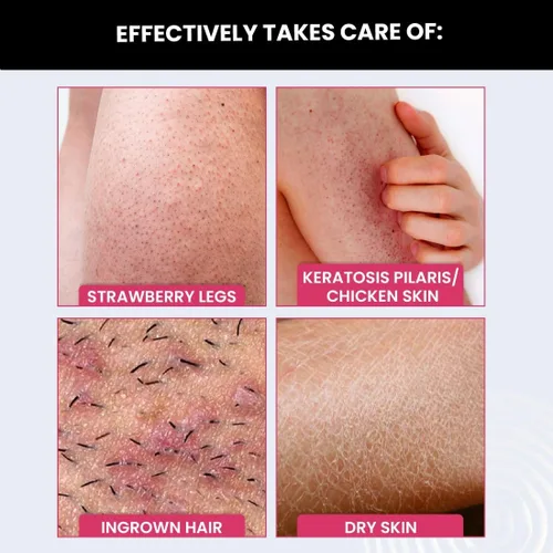 Vista 3 de Borrador exfoliante suavizante de golpes Para piel áspera y con baches con espirulina, ácido glicólico y ácido láctico para hombres y mujeres