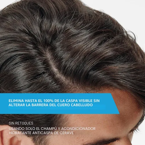 Vista 2 de CeraVe Acondicionador hidratante anticaspa, tratamiento de caspa de zinc piritiona al 0,5% con ceramidas, ácido hialurónico y niacinamida, ayuda a