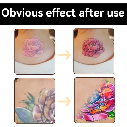 Vista 5 de Simple: manteca de tatuaje, bálsamo de cuidado posterior del tatuaje, cuidado del tatuaje, mejora del color que revive tatuajes viejos, hidrata