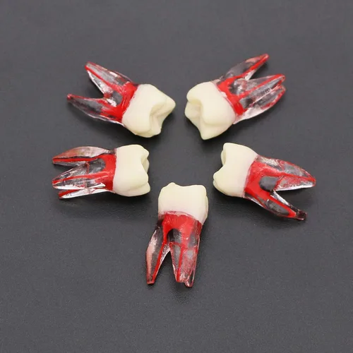Vista 2 de 10 unids dientes modelo endodoncia archivo práctica pulpa para enseñanza estudio M807 16 #